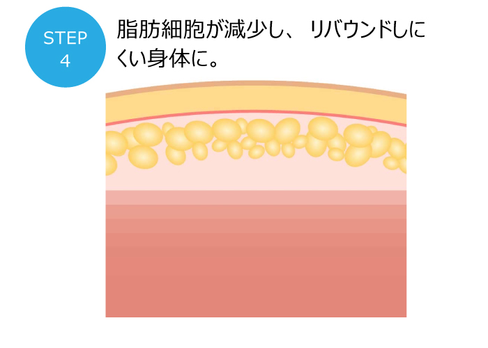 Frozen Philippe (フローズンフィリップ) 冷却マシン
