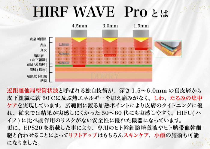 HIRF WAVE Proとは